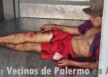 Hombre sospechoso acuchillado en El Salvador 4573