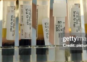 Científicos de Japón desarrollaron sangre artificial universal compatible con cualquier tipo sanguíneo