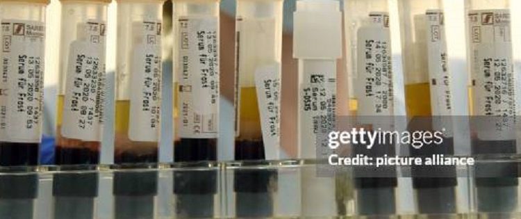 Científicos de Japón desarrollaron sangre artificial universal compatible con cualquier tipo sanguíneo