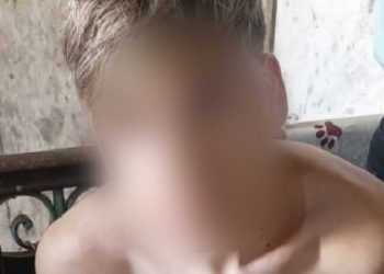 Primero cayó “El Dengue” y ahora su cómplice: la Policía de la Ciudad detuvo al “Chikunguña” por robos a comercios