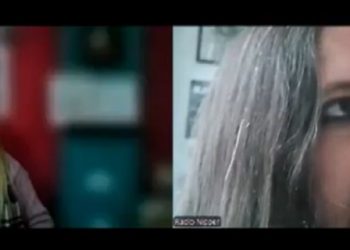 El síndrome de Dorian Gray: «For ever young»