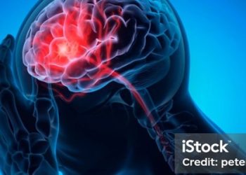 Elon Musk: «Los implantes cerebrales podrìan comenzar a probarse dentro de 6 meses»
