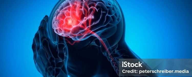 Elon Musk: «Los implantes cerebrales podrìan comenzar a probarse dentro de 6 meses»
