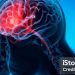 Elon Musk: «Los implantes cerebrales podrìan comenzar a probarse dentro de 6 meses»